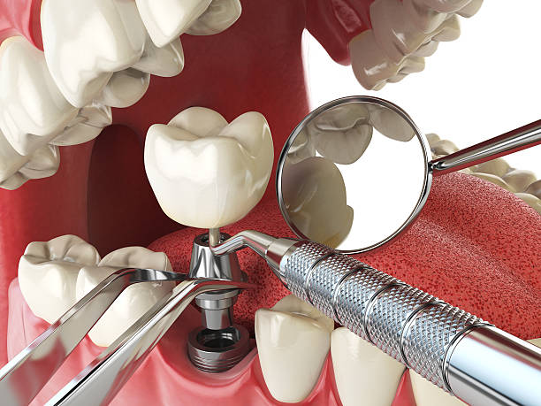 Best Emergency Gum Treatment in Montauk, NY
